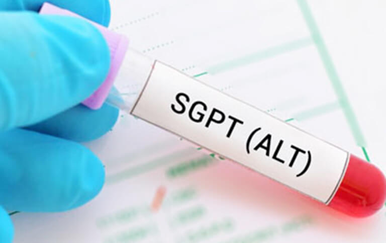 Chỉ số Alt là gì? Ý nghĩa Alt trong xét nghiệm bệnh GAN